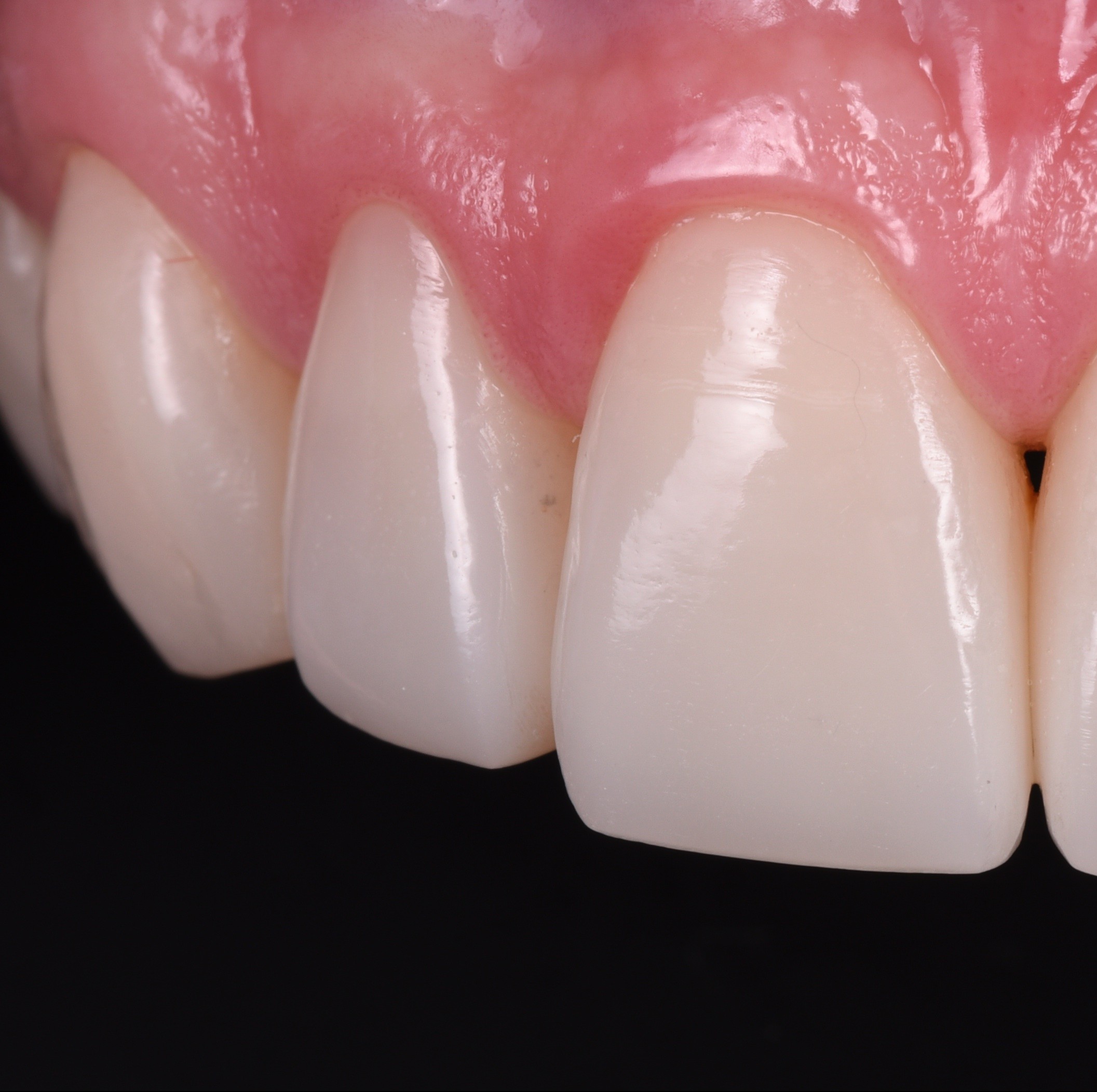 posterior-perfection-anterior-artistry